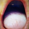 ) You haven't had a blow job til you've had a gum job [